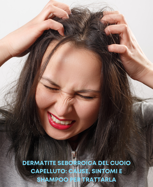 Dermatite seborroica del cuoio capelluto: cause, sintomi e trattamenti